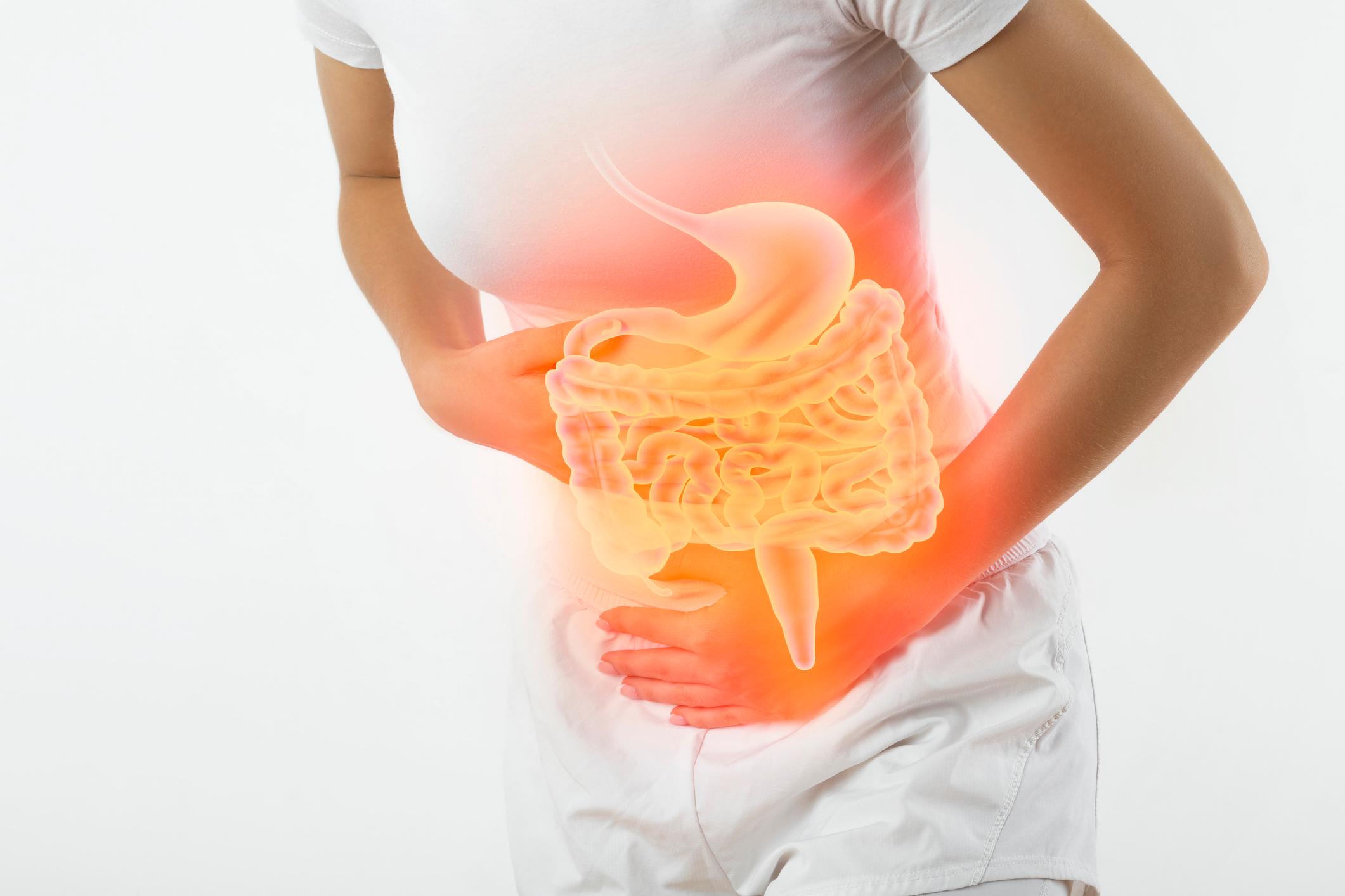 sindrome-intestino-irritabile