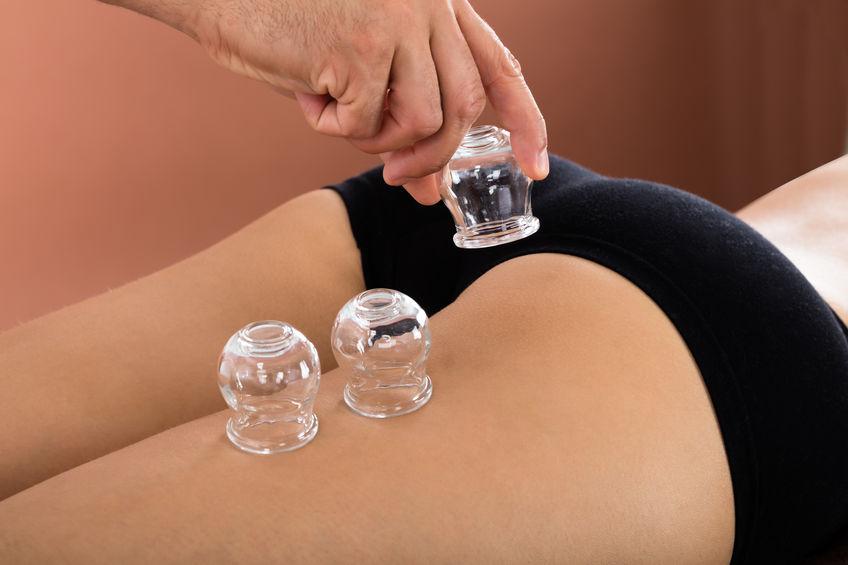 cup-anti-cellulite cup-anti-cellulite